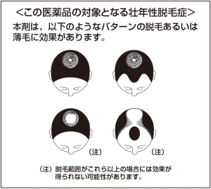 加美乃素デルタ_適用患者図